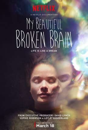 Filme My Beautiful Broken Brain 2016 Torrent